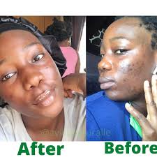 Skin Care Solution Abuja (@dublishop_international) · Instagram 照片和视频