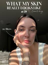 WHAT MY SKIN REALLY LOOKS LIKE