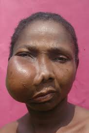 Earthwide Surgical Foundation: May 2012