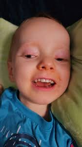 Day +578: I want to...