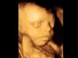 4d ultrasound pictures at 27 weeks. Amazing 27 Weeks Ultrasound 4d Baby No 3 Youtube