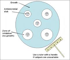 With slow growing organisms, increased incubation may cause. Mueller Hinton Agar Mha Composition Preparation Uses Microbe Online