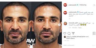 وأحيا أحمد سعد، في المسلسل، حفل زفاف طليقته سمية الخشاب، على محمد رمضان، ضمن ونشر المطرب أحمد سعد على حسابه بموقع الصور إنستغرام صورا من كواليس حلقة موسى. Ø±ÙŠÙ… Ø§Ù„Ø¨Ø§Ø±ÙˆØ¯ÙŠ ØªØ³ÙŠØ¡ Ù„Ø£Ø­Ù…Ø¯ Ø³Ø¹Ø¯ Ø¨Ø¹Ø¯ Ø¹Ù…Ù„ÙŠØ© Ø§Ù„ØªØ¬Ù…ÙŠÙ„ Ø­ÙŠØ§ØªÙ†Ø§ Ø¬Ù‡Ø§Øª Ø§Ù„Ø¥Ù…Ø§Ø±Ø§Øª Ø§Ù„ÙŠÙˆÙ…