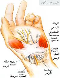 اوجاع وتنميل اليد | متلازمة النفق الرسغي carpal tunnel syndrome – طبيب