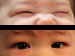 Use of omeprazole during pregnancy — no hazard demonstrated in 955 infants. Shaky Jerky Eyes In An 8 Week Old Infant Clinical Advisor