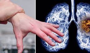 If you have a persistent cough, tell your doctor immediately, notes the go2 foundation for lung cancer. Do You Have Finger Clubbing It Could Indicate You Have Lung Cancer What To Look For Sound Health And Lasting Wealth