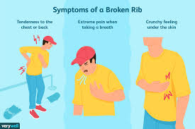 Its normal to see rib cage but its not sufficient information to garantee you are normal. Broken Rib Overview And More