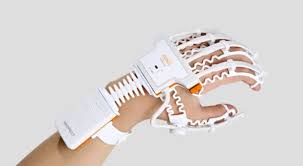 Rapael Smart Glove uses A.I. to help patients rehab at home - Gearbrain