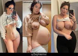 Sxphiemxi before, during, and after pregnancy : rbeforevsafter