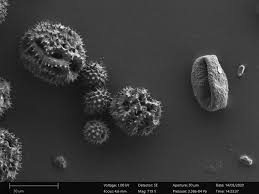 Maybe you would like to learn more about one of these? Zeiss Microscopy On Twitter How Do Pollen Look Like Under A Scanning Electron Microscope Join Martyjopson And Globalscishow This Friday At 12 30 Bst And Explore Them Up Close Https T Co Eyfvmydwm5 Microminute Https T Co Yjfgwcliea