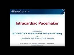 How long do pacemaker batteries generally last? Intracardiac Pacemaker In Icd 10 Pcs Cardiovascular Procedure Coding Youtube