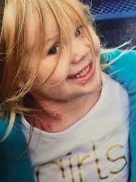 Hello friends . I need quick hepl. Is it allergyc reaction here is photo's  which send me my client. Never happend to me.