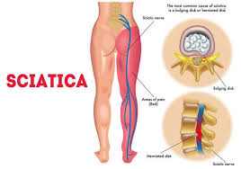 Lower back tightness is a common complaint among many people. Experiencing Pain In The Lower Back Aradhya Orthopaedic Clinic Facebook