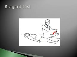 Una profesional de fisaude te enseña como realiza el test de bragard. An Orthopaedic Overview Ppt Video Online Download