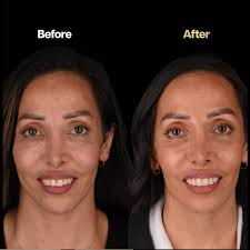 Meet Dr. Jeffery Albert! Jeff holds a Bachelor of Dental Surgery and a  Graduate Diploma in Clinical Dentistry, both from the University of Sydney.  He was also granted a Fellowship from the