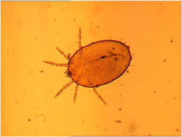 Image result for Trombicula autumnalis bites