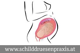 Was darf man in der schwangerschaft nicht essen? Schilddruse Und Schwangerschaft
