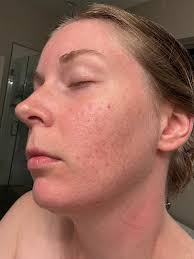 Anything specific that helps with brain fog?