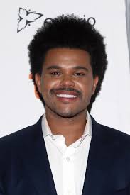 These things are normal and shouldn't cause concern. Has The Weeknd Had Plastic Surgery