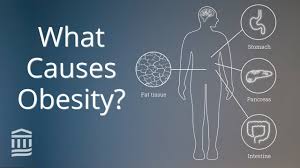 Image result for Obesity