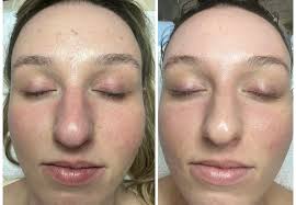 Abbie Major Skin Love