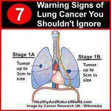Shortness of breath or becoming easily winded are also possible symptoms of lung cancer. How Would U Know If U Had Lung Cancer Lung Cancer Cancer Council Nsw Others Do Have Symptoms But Because Those Symptoms Are So Vague Mistakenly Attribute Them To Minor Illnesses