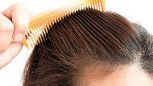 E questo scatena, circa 3 mesi . Perche Cadono I Capelli Dopo Il Parto