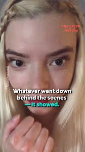 😳 Anya Taylor-Joy Can’t Stand Timothée Chalamet?!