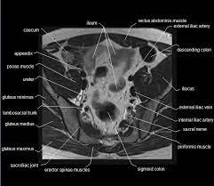 Mri Pelvis Anatomy Free Male Pelvis Axial Anatomy