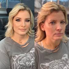 TOP 10 BEST Hydrafacial near Oak Creek, WI