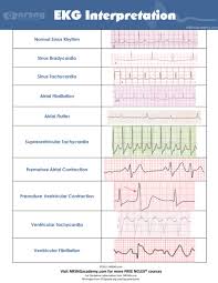 Interpret Ekgs Strips Like A Boss Ekg Interpretation For