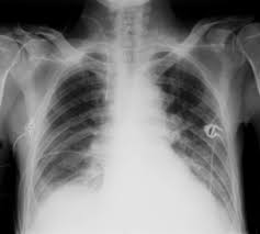 Maybe you would like to learn more about one of these? Case Studies In Respiratory Physiotherapy Musculoskeletal Key