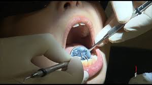 Foods with hidden sugars harmful for children's health