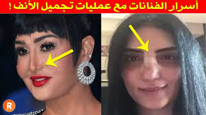 ما هي أشعر عمليات التجميل التي تجرى في إيران؟ كيف أرتب لرحلتي إلى إيران؟ ما هي أرخص الفنادق، وما هي أكثرها رفاهية في إيران؟ أين يمكنني التنزه والاستمتاع برحلتي في إيران بعد أو قبل الانتهاء من عملية التجميل؟ كل هذا وأكثر تعرفونه معنا من خلال هذا المقال. Ø§Ù„Ø°ÙƒØ± Ø¹Ø§Ø±Ø¶ ÙˆØµÙ Ø¹Ù…Ù„ÙŠØ§Øª ØªØ¬Ù…ÙŠÙ„ Ø§Ù„Ø§Ù†Ù Ù„Ù„Ø±Ø¬Ø§Ù„ Ù‚Ø¨Ù„ ÙˆØ¨Ø¹Ø¯ Dsvdedommel Com