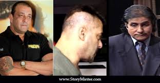 7 B Town Celebs Who Have Undergone Hair Transplant Surgery Story Minter have undergone hair transplant surgery