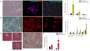 0.001), stromal atypia (p = 0.003), and stromal mitosis (p = 0.002) increased (fig. Plos One Multipotent Cancer Stem Cells Derived From Human Malignant Peritoneal Mesothelioma Promote Tumorigenesis