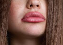 The Ultimate Guide To Dissolving Filler: What You Need To Know - Aesthetics  By Stephanie - Livingston