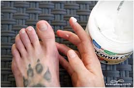 Baking soda has antiseptic and antifungal properties. 3 Simple Home Remedies For Toenail Fungus Everyday Roots