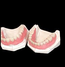 These diy denture methods are easy to follow and master and the best part is that each will cost you a fraction of the cost of dental repairs. Pin On Stuff To Buy