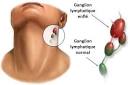 Anticorps antithyrodiens (AAT) : Quaposest-ce que caposest? Analyse