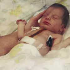 40 years of transplantation at Loma Linda