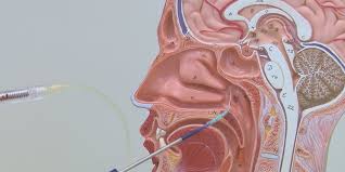 Image result for sinuses
