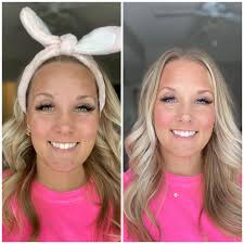 Cream makeup for melasma coverage