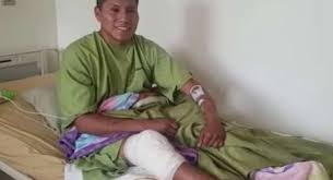 Below you will find a lot of statistics that make it easier predict the result for a match between. Kumpulan Berita Chapecoense Ajaib Korban Selamat Tragedi Pesawat Chapecoense Kembali Lolos Dari Maut