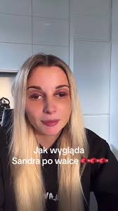 Sandra Smoroń: Regeneracja po walce i live!