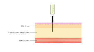 Image result for Subcutaneous Injection