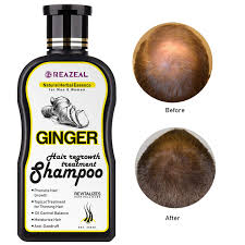 Lipogaine is another hair loss shampoo that focuses on a strong formula of hair thinning prevention ingredients. Buy Hair Regrowth Shampoo Anti Hair Loss Shampoo Natural Old Ginger Hair Care Shampoo For Hair Growth And Strengthener Hair Loss Treatment Organic Hair Regrowth For Women Men Online In Indonesia B07wqmw34p