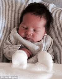 Time is the best treatment for newborn lanugo. Parents Reveal Their Babies With Full Heads Of Hair Daily Mail Online