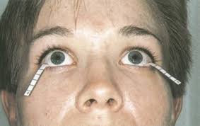 El Ojo Seco Ii Sintomas Y Signos Ocularis