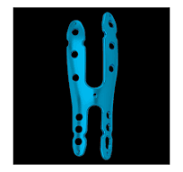 Greater Trochanter H Plate,Medical Device Manufacturers ...